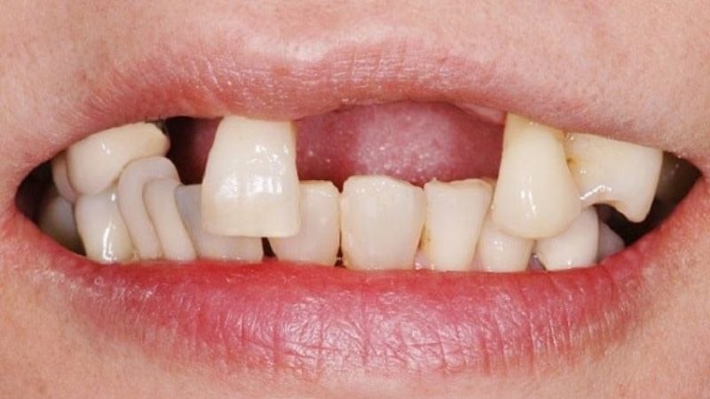 Giải mã những chi tiết nhỏ trong giấc mơ